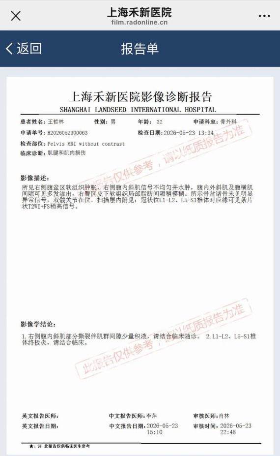 萨里奇大概率重返欧洲篮坛